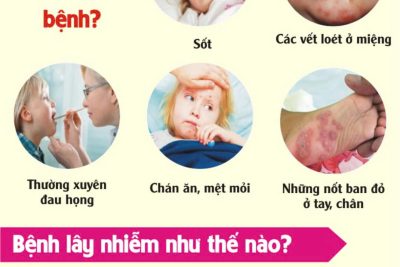 Bài tuyên truyền phòng bệnh chân tay miệng