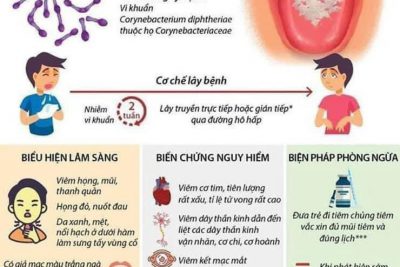 PHÒNG CHỐNG BỆNH BẠCH HẦU