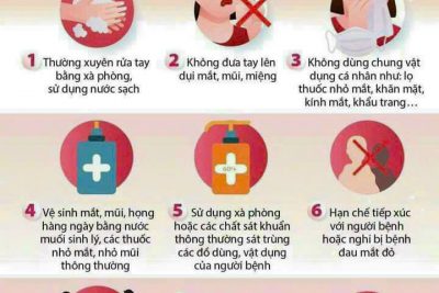 Phòng ngừa bệnh đau mắt đỏ